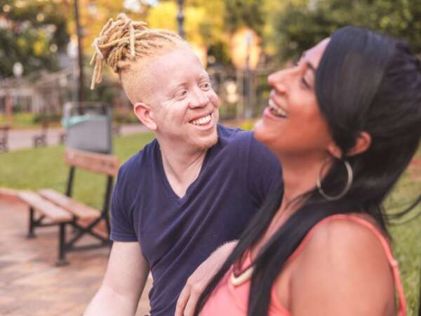Red eyes a rare kind of albinism